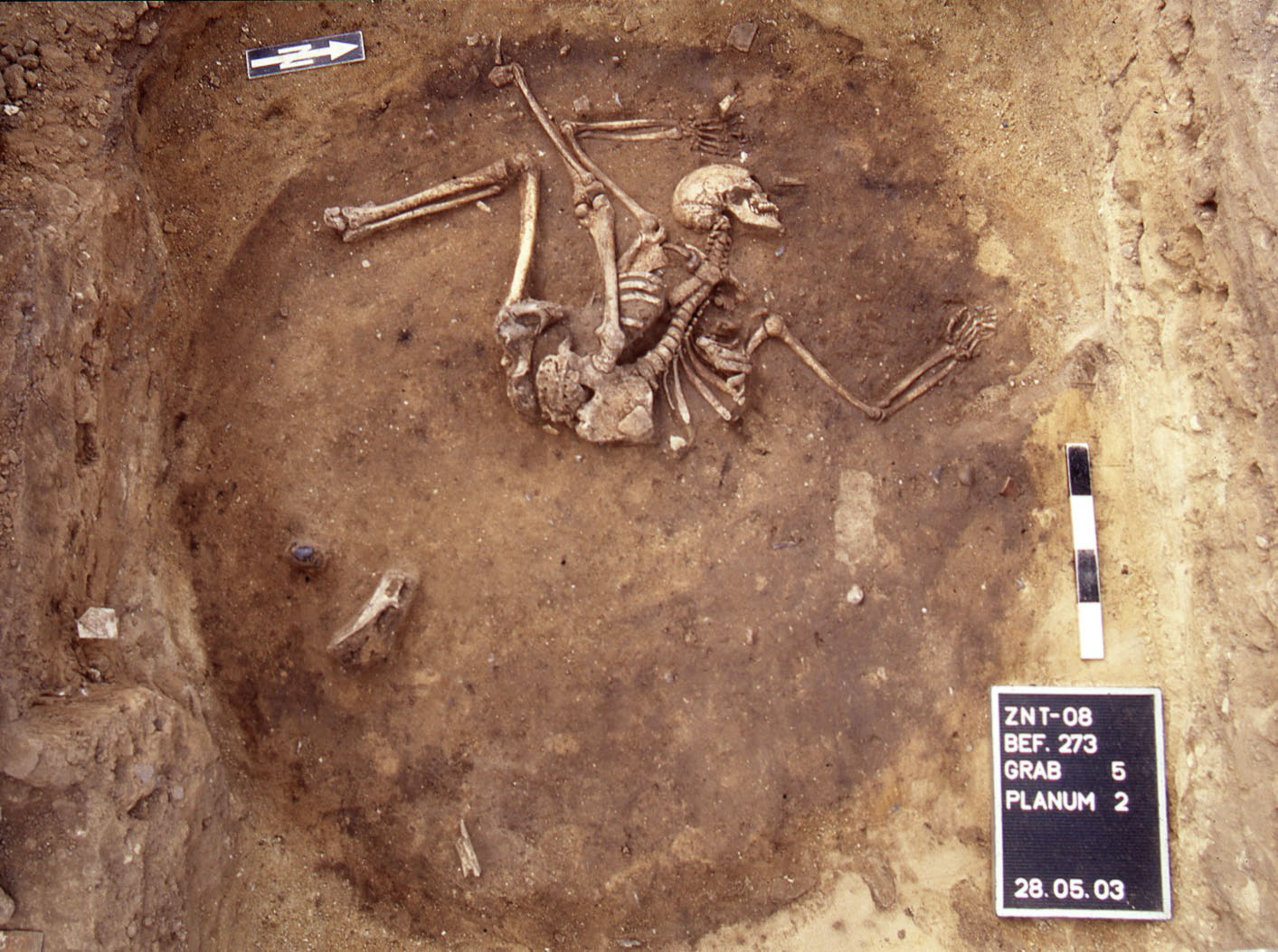 Special burials